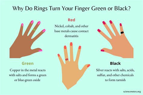 ring turns finger green|finger blue after wearing ring.